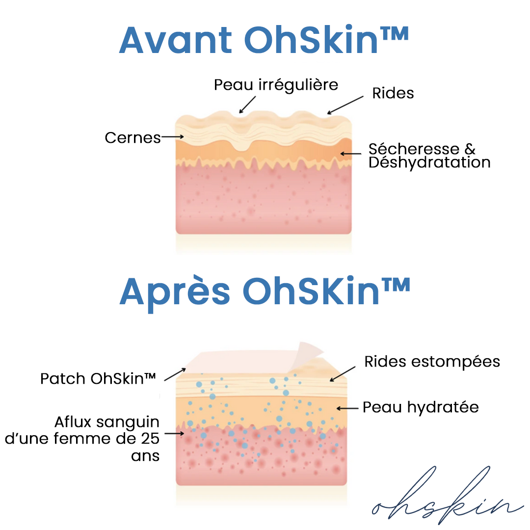 Votre deuxième pack ohskin